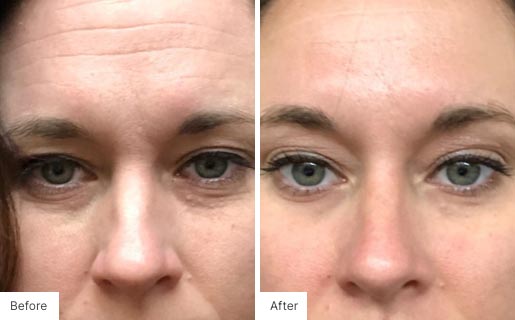 5 - Before and After Real Results image for Age IQ Night Cream